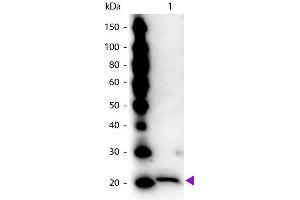 Ferritin Antikörper