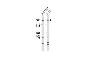 All lanes : Anti-DYNC1H1 Antibody (C-term) at 1:2000 dilution Lane 1: U-87 MG whole cell lysates Lane 2: PC-3 whole cell lysates Lysates/proteins at 20 μg per lane. (DYNC1H1 Antikörper  (C-Term))