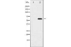 Western blot analysis of FOXO4 expression in K562 whole cell lysates,The lane on the left is treated with the antigen-specific peptide.