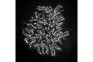 NCAPH2 antibody (mAb) (Clone 5F2G4) tested by immunofluorescence. (NCAPH2 Antikörper)