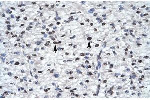 Rabbit Anti-GLI2 Antibody  Paraffin Embedded Tissue: Human Heart Cellular Data: Myocardial cells Antibody Concentration: 4. (GLI2 Antikörper  (Middle Region))