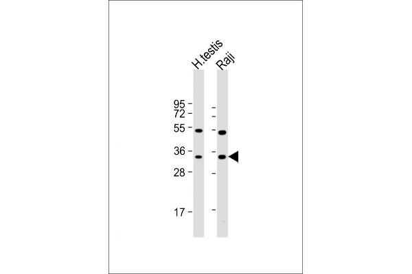 HSD17B3 anticorps  (AA 89-118)
