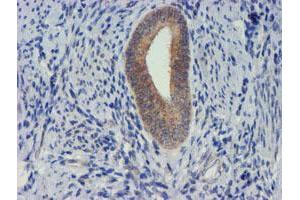 Image no. 1 for anti-Metalloproteinase Inhibitor 2 (TIMP2) antibody (ABIN1501394) (TIMP2 Antikörper)