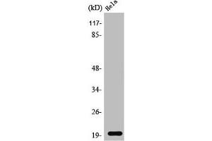 Western Blot analysis of Jurkat cells using SRp20 Polyclonal Antibody (SRSF3 Antikörper  (C-Term))