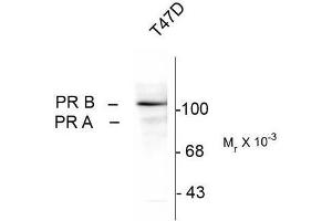 Western Blotting (WB) image for anti-Progesterone Receptor (PGR) (pSer294) antibody (ABIN371835) (Progesterone Receptor Antikörper  (pSer294))