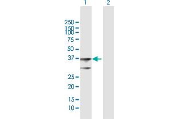 BDH1 Antikörper  (AA 1-343)