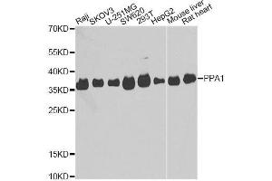 Western blot analysis of extracts of various cell lines, using PPA1 antibody. (Pyrophosphatase (Inorganic) 1 (PPA1) (AA 1-289) Antikörper)
