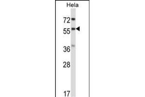 RANG Antibody (N-term) 3776a western blot analysis in Hela cell line lysates (35 μg/lane). (RANGAP1 Antikörper  (N-Term))
