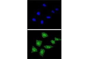 Confocal immunofluorescent analysis of SOD1 antibody with 293 cells followed by Alexa Fluor 488-conjugated goat anti-rabbit lgG (green). (SOD1 Antikörper  (AA 55-84))