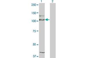 Western Blot analysis of KIT expression in transfected 293T cell line by KIT monoclonal antibody (M04), clone 1G1. (KIT Antikörper  (AA 41-140))