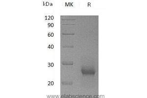 Western Blotting (WB) image for TIMP Metallopeptidase Inhibitor 1 (TIMP1) protein (ABIN7320662) (TIMP1 Protein)