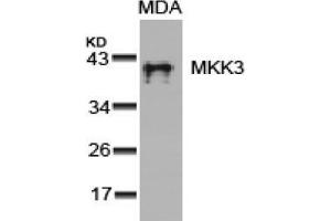 Image no. 3 for anti-Mitogen-Activated Protein Kinase Kinase 3 (MAP2K3) (Ser189) antibody (ABIN197296) (MAP2K3 Antikörper  (Ser189))