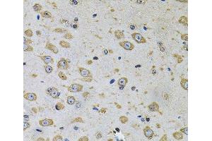 Immunohistochemistry of paraffin-embedded Rat brain using RhoA Polyclonal Antibody at dilution of 1:100 (40x lens). (RHOA Antikörper)