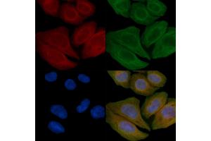 ABIN6259404 and ABIN6276174 staining Hela cells(45 min of heat-shock) by IF/ICC.