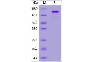 Human CD32b/c, HSA,His Tag on  under reducing (R) condition. (FCGR2B Protein (AA 46-217) (HSA,His tag))