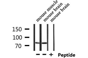 Western blot analysis of extracts from mouse muscle and mouse brain, using USP51 Antibody. (USP51 Antikörper)