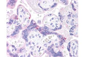 ABCB1 antibody was used for immunohistochemistry at a concentration of 4-8 ug/ml. (ABCB1 Antikörper)