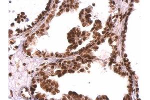Immunohistochemistry (IHC) image for anti-Growth Factor Receptor-Bound Protein 2 (GRB2) (C-Term) antibody (ABIN2854697)