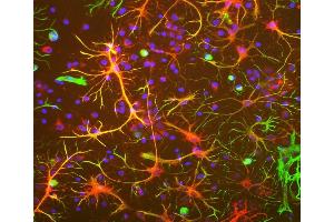 Neuron-glia cell mixed cultures stained with ABIN1842234 (red) and our chicken polyclonal antibody against vimentin: CPCA-Vim (green). (Aldehyde Dehydrogenase H1L1 Antikörper)