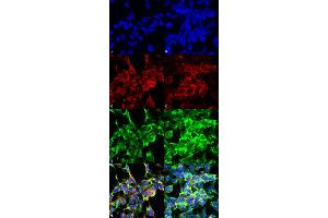 Immunocytochemistry/Immunofluorescence analysis using Mouse Anti-Methylglyoxal Monoclonal Antibody, Clone 9E7 . (Methylglyoxal (MG) Antikörper (Biotin))