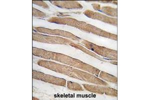 Formalin-fixed and paraffin-embedded human skeletal muscle tissue reacted with ITGB1BP3 antibody , which was peroxidase-conjugated to the secondary antibody, followed by DAB staining.