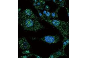 Immunofluorescence (IF) image for anti-Notch 3 (NOTCH3) antibody (ABIN3002554) (NOTCH3 Antikörper)