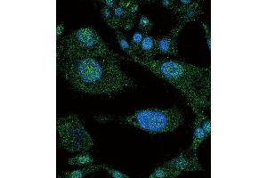 Immunofluorescence (IF) image for anti-Notch 3 (NOTCH3) antibody (ABIN3002554)