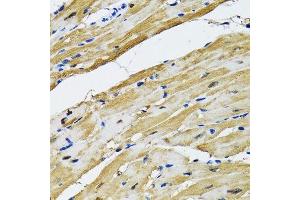 Immunohistochemistry of paraffin-embedded rat heart using GOT1 antibody. (GOT1 Antikörper  (AA 244-413))