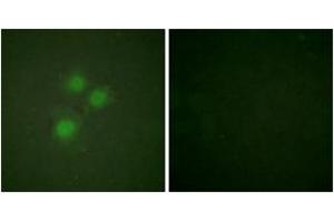 Immunofluorescence analysis of HuvEc cells, using NIFK (Ab-234) Antibody.