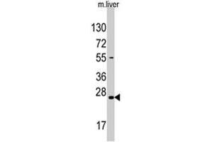Western blot analysis of SOST polyclonal antibody  in mouse liver tissue lysate (35 ug/lane). (Sclerostin Antikörper  (N-Term))