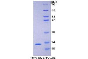 SDS-PAGE (SDS) image for Intercellular Adhesion Molecule 5 (ICAM5) (AA 164-441) protein (His tag) (ABIN2125367)