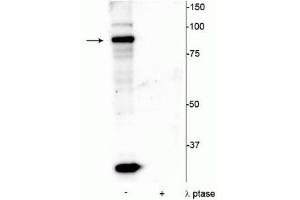 Western blot of mouse testicular lysate showing specific immunolabeling of the ~86 kDa ATRIP protein phosphorylated at Ser239 in the first lane (-). (ATRIP Antikörper  (pSer239))