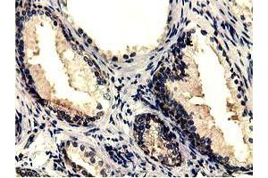 Immunohistochemical staining of paraffin-embedded Human prostate tissue using anti-CBWD1 mouse monoclonal antibody. (CBWD1 Antikörper)
