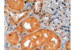ABIN184828 (2µg/ml) staining of paraffin embedded Human Kidney. (RPS6KB1 Antikörper  (C-Term))