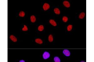Confocal immunofluorescence analysis of U-2 OS cells using CTCF Polyclonal Antibody at dilution of 1:100. (CTCF Antikörper)