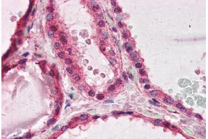 Human Thyroid (formalin-fixed, paraffin-embedded) stained with PAFAH1B1 antibody ABIN364420 at 3. (PAFAH1B1 Antikörper  (AA 397-410))