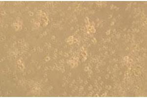 Proliferation Assay (ProA) image for CD83 (CD83) (AA 20-143) (Active) protein (His tag) (ABIN7607515)