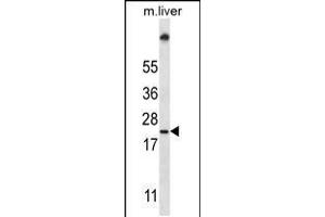 Western blot analysis in mouse liver tissue lysates (35ug/lane). (UBE2W Antikörper  (C-Term))