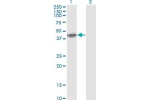 Western Blot analysis of FCER2 expression in transfected 293T cell line by FCER2 monoclonal antibody (M04A), clone S51. (FCER2 Antikörper  (AA 1-321))