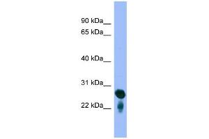 WB Suggested Anti-RAB5C Antibody Titration: 0. (Rab5c Antikörper  (Middle Region))