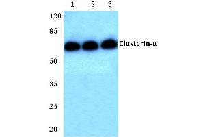 Western blot (WB) analysis of Clusterin-α antibody at 1/500 dilution (Clusterin Antikörper)