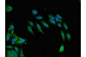 Immunofluorescent analysis of Hela cells using ABIN7171209 at dilution of 1:100 and Alexa Fluor 488-congugated AffiniPure Goat Anti-Rabbit IgG(H+L) (SNCAIP Antikörper  (AA 309-553))