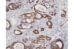 Immunohistochemistry (IHC) image for anti-Keratin 8 (KRT8) (C-Term) antibody (ABIN870546) (KRT8 Antikörper  (C-Term))