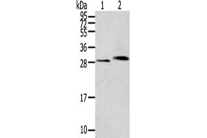 Western blot analysis of Human normal kidney tissue Human liver tissue using CLIC4 Polyclonal Antibody at dilution of 1:200 (CLIC4 Antikörper)