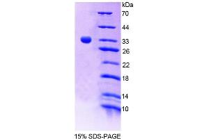 SDS-PAGE analysis of Human TESK1 Protein. (TSSK1 Protein)