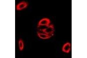 Immunofluorescent analysis of Fis1 staining in MCF7 cells. (Fission 1 Antikörper)