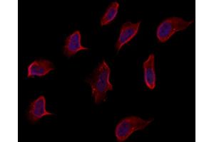 ABIN6262960 and ABIN6273263 staining Hela by IF/ICC. (EIF2D Antikörper  (Internal Region))