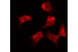 Immunofluorescence (fixed cells) (IF/ICC) image for anti-Ezrin (EZR) (pTyr353) antibody (ABIN6256714)