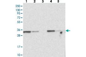 Western blot analysis of Lane 1: RT-4, Lane 2: U-251 MG, Lane 3: Human Plasma, Lane 4: Liver, Lane 5: Tonsil with MTCH2 polyclonal antibody . (MTCH2 Antikörper)