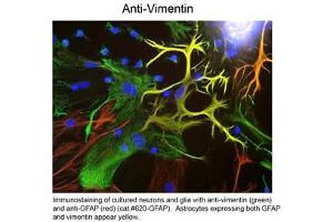 IF - Vimentin Immunofluorescence Microscopy of Chicken anti-Vimentin antibody.